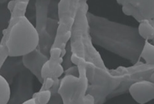 Structure des composites de collagène observée en Microscopie Electronique à Balayage